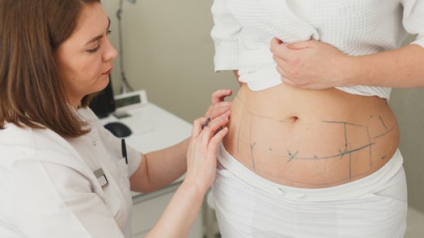 الكمية المسموح بإزالتها وفقاً للمعايير العالمية هي 5- 7 % من وزن الشخص (shutterstock.com)
 الكمية المسموح بإزالتها وفقاً للمعايير العالمية هي 5- 7 % من وزن الشخص (shutterstock.com)