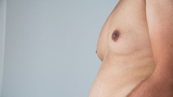 بالرغم من أن هذه المشكلة ليست خطيرة، إلا أنها تشكل الإحراج لدى الرجال (shutterstock.com)
 بالرغم من أن هذه المشكلة ليست خطيرة، إلا أنها تشكل الإحراج لدى الرجال (shutterstock.com)