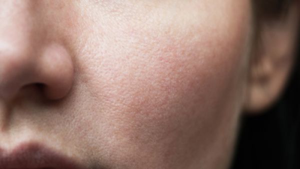 يتم تحضير هذه الوصفة خلال دقائق  (shutterstock.com)
