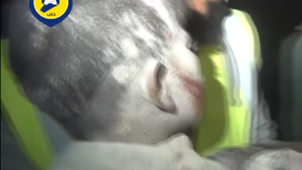 الأطفال ضحايا القصف الروسي والسوري على أحياء حلب المحاصرة