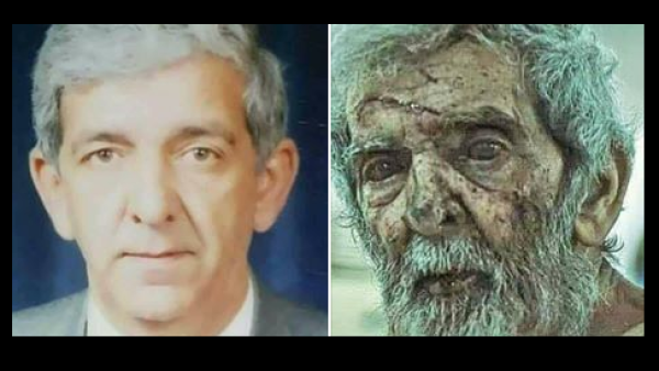 الكعكجي توفي متأثرا بإصابته نهاية تموز/ يوليو الماضي