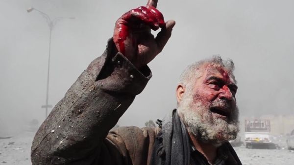 مشروع القرار يهدف إلى إنهاء المذبحة في الغوطة الشرقية وغيرها من المناطق في سوريا