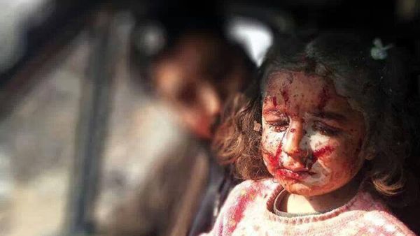 طفلة بريئة ضحية للحرب في سوريا 