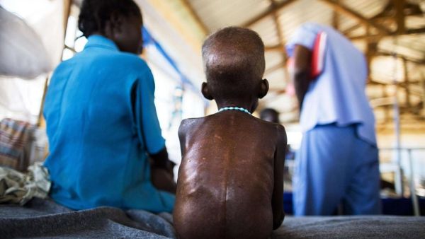 14 مليون شخص يواجهون خطر الجوع في دول جنوب أفريقيا