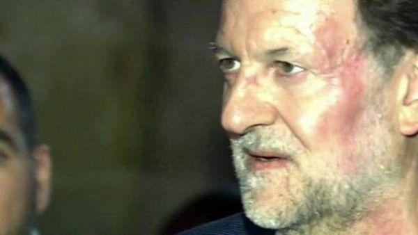 رئيس الحكومة الاسبانية ماريانو راخوي واثار اللكمة بادية في وجهه