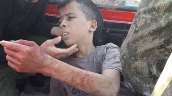 بأي ذنب الطفولة تذبح