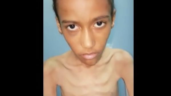 تعنيف طفل في خيبر