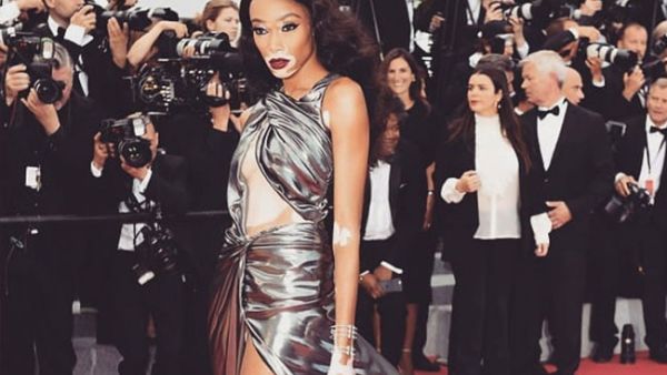 The 23-year-old Canadian model Winnie Harlow looked sensational as she flaunted her statuesque figure (Source: winnieharlow/ Instagram)
