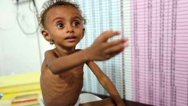 الأمم المتحدة تحذر من تعرض نحو 14 مليون يمني للمجاعة الأمم المتحدة تحذر من تعرض نحو 14 مليون يمني للمجاعة