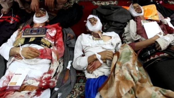 مقتل وإصابة العشرات في ساحة التغيير بالعاصمة صنعاء