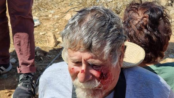 الجيش الاسرائيلي يعاتب ضابطا اعتدى بوحشية على ناشط يساري بالضفة