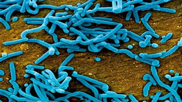 فيروس "ماربورغ" الشبيه بـ"‘إيبولا" يتفشى في غانا