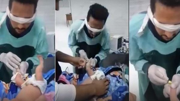 مصر.. طفل تحدي الكانيولا عانى آلاما تفوق البالغين بأربعة أضعاف