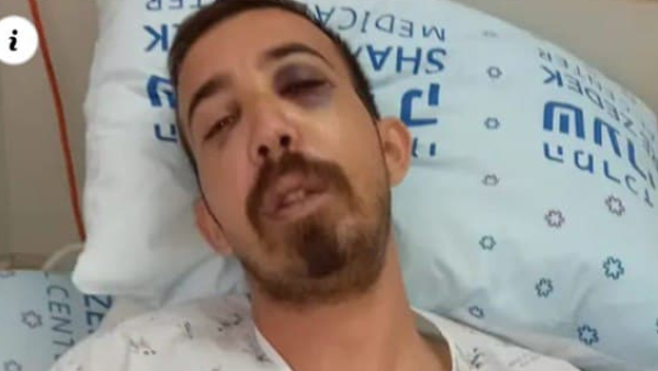 مستوطنون ينكلون بشاب يهودي بعدما ظنوه فلسطينيا