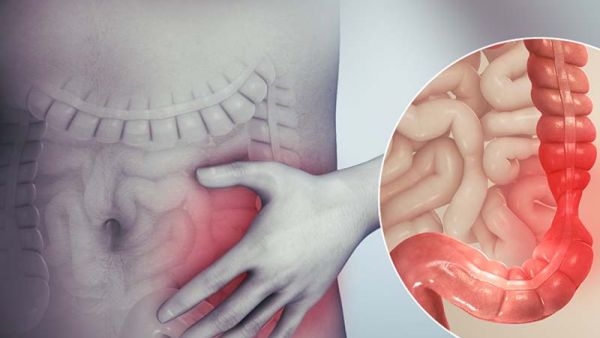أفضل علاج للقولون من الصيدلية