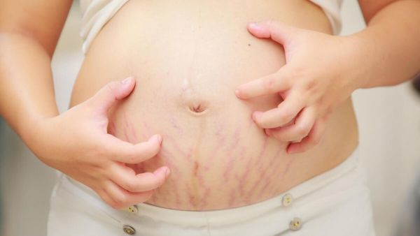 الحكة عند الحامل في الشهر الرابع ونوع الجنين الحكة عند الحامل في الشهر الرابع ونوع الجنين