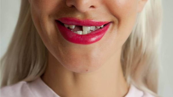 تفسير حلم سقوط سن واحد بجميع دلالاته تفسير حلم سقوط سن واحد بجميع دلالاته