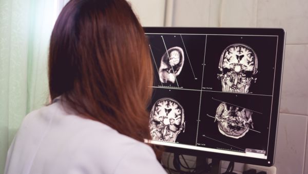 ضمور المّخ من الأمراض العصبيّة التي تصيب الأعصاب