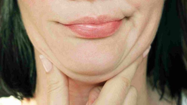 مضغ العلكة باستمرار من شأنه المساعدة على التخلّص من الذقن المزدوج