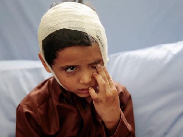 Saudi coalition admits it bombed bus full of children in Yemen (Twitter)