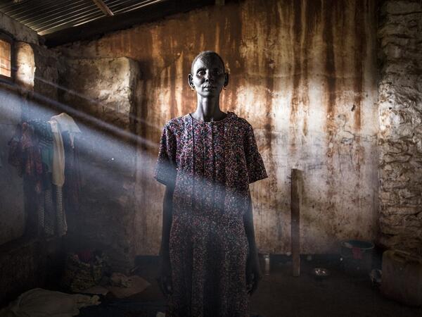 Elizabeth, a South Sudanese Refugee, poses inside a refugee transition camp in Aru for South Sudanese who have just arrived in the Democratic Republic of the Congo.  JOHN WESSELS / AFP