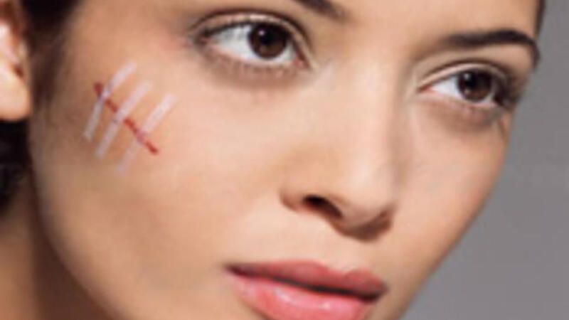 اسباب صعوبة إلتئام الجروح المرسال