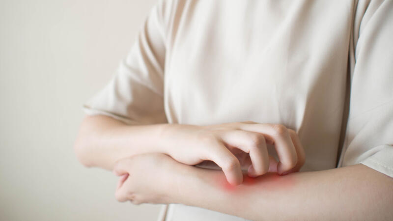 حساسي ة الجلد الأعراض المسببات