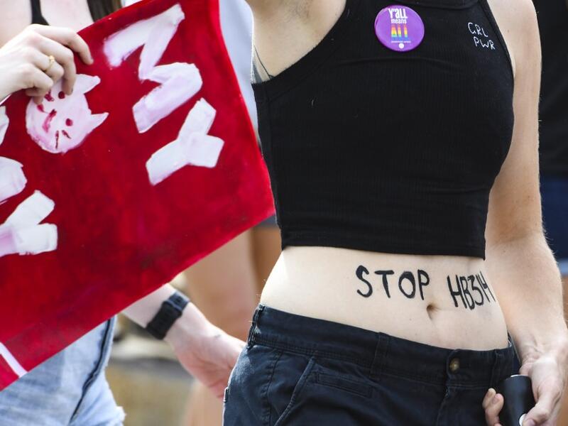 Demonstrators gathered to protest HB 314, a bill passed by the Alabama Legislature last week making almost all abortion procedures illegal. Julie Bennett/Getty Images/AFP