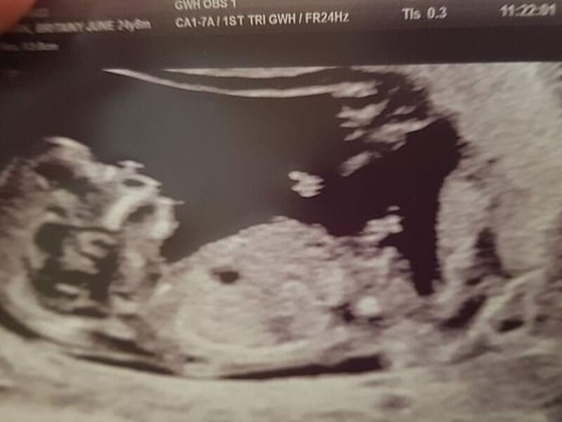 The couple were shocked to see what they believe is a guardian angel (top right) in the 12-week scan. (Daily Mail)