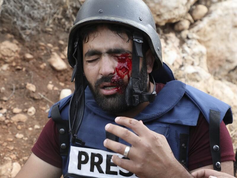 Palestinian cameraman Mu'ath Amarneh gestures after he was hit on the face by a rubber bullet from Israeli border police during clashes between Palestinians and Israeli security forces in the village of Surif northwest of the West Bank town of Hebron on November 15, 2019. HAZEM BADER / AFP