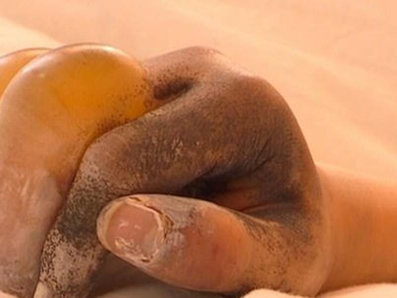 Lu Yanyan's fingers swelled and turned black after she was ordered to work sweep snow (dailymail)