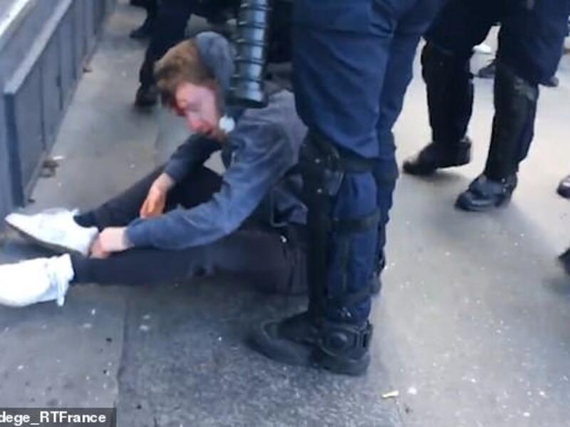 The bloodied protester is pictured here on Twitter. Reportedly, this was shortly after the attack. (Twitter)