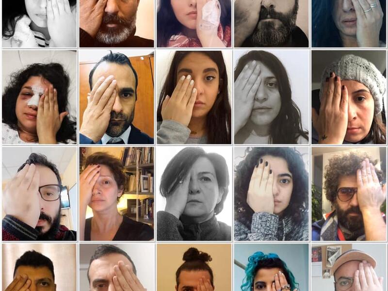 The activists posted selfies whilst covering one eye under the Arabic hashtag, #ثورتنا_عيونكم which loosely translates to "Our Revolution is Your Eyes". (Twitter)