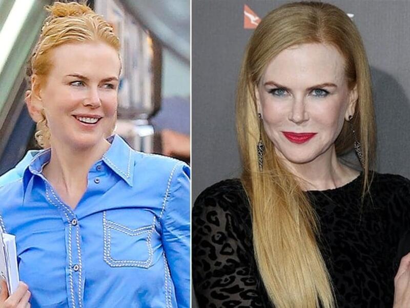 Nicole Kidman