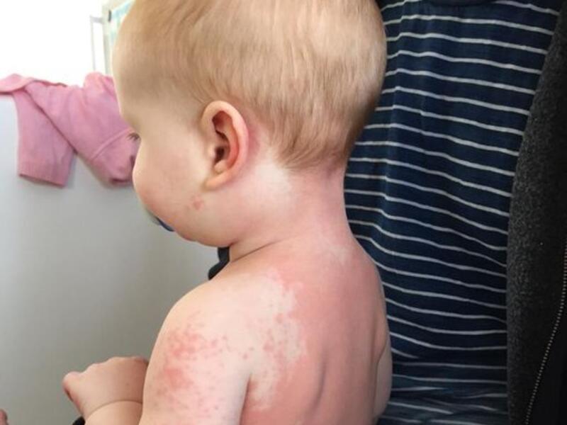 Eight month old Alexander Parsons (Twitter)
