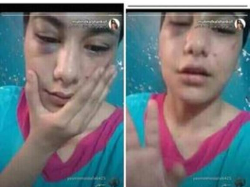 Raped and Forced to Deny It Online: Police Report on Egyptian Tiktok Star's Case