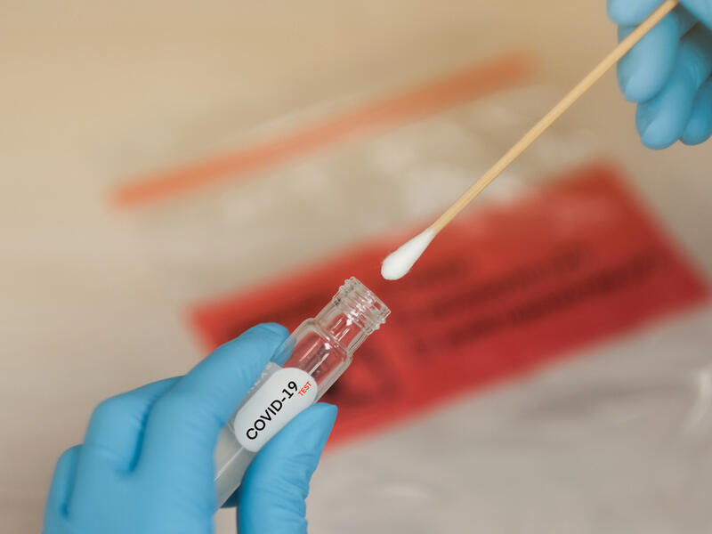 That virus, named RaBtCoV/4991 at the time, now appears to be the closest relative to SARS-Cov-2, which is causing Covid-19. (Shutterstock/ File Photo)