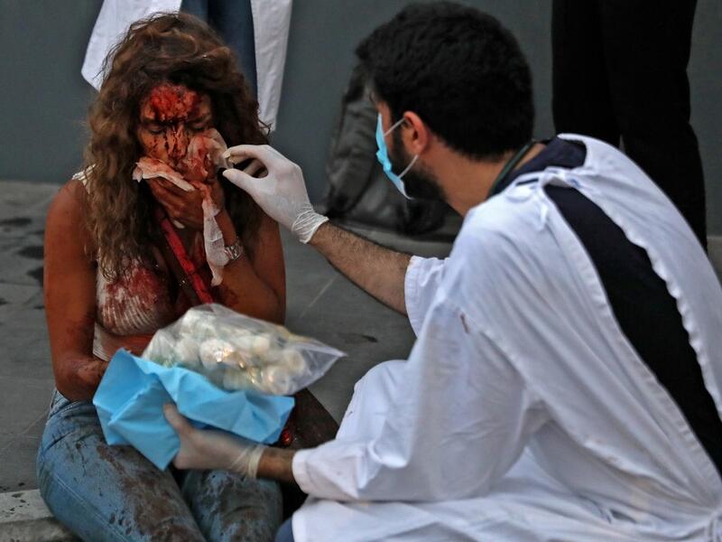 A wounded woman receives help outside a hospital following an explosion in the Lebanese capital Beirut on August 4, 2020. Two huge explosion rocked the Lebanese capital Beirut, wounding dozens of people, shaking buildings and sending huge plumes of smoke billowing into the sky. Lebanese media carried images of people trapped under rubble, some bloodied, after the massive explosions, the cause of which was not immediately known.  IBRAHIM AMRO / AFP