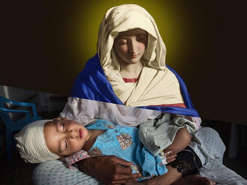 At the Emergency hospital Najiba holds her nephew Shabir, age 2, who was injured from a bomb blast which killed his sister in Kabul on March 29, 2016. Najiba had to stay with the children as their mother buried her daughter. (ugurgallen/ Instagram)