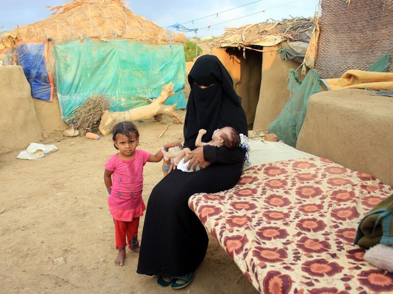 A woman carries a young infant suffering from severe malnutrition since birth in Yemen's northern Hajjah province on December 6, 2020. ESSA AHMED / AFP