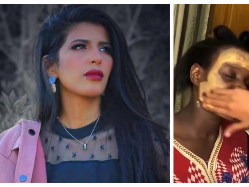 الناشطة اليمنية أروى عمر:  ظهرت في فيديو مع العاملة المنزلية وهي تضع كريم الأساس "فاونديشن" فاتح اللون كي تخفي لون بشرتها، وقالت: رح ندعكة ورح يصير بيضا بيضا".