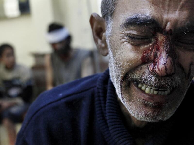  Kamal, the father of an eight-year-old girl who was fatally wounded along with his son Hamed 