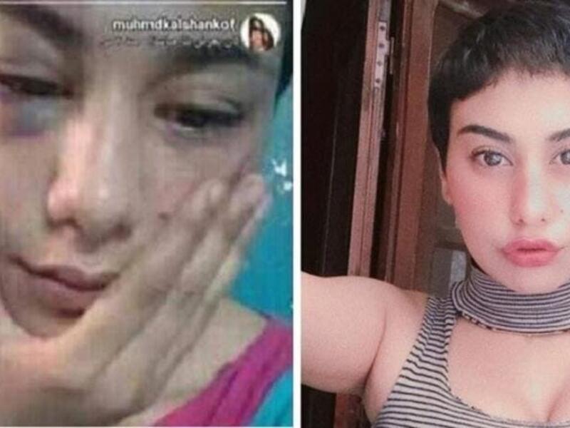 منة عبد العزيز
