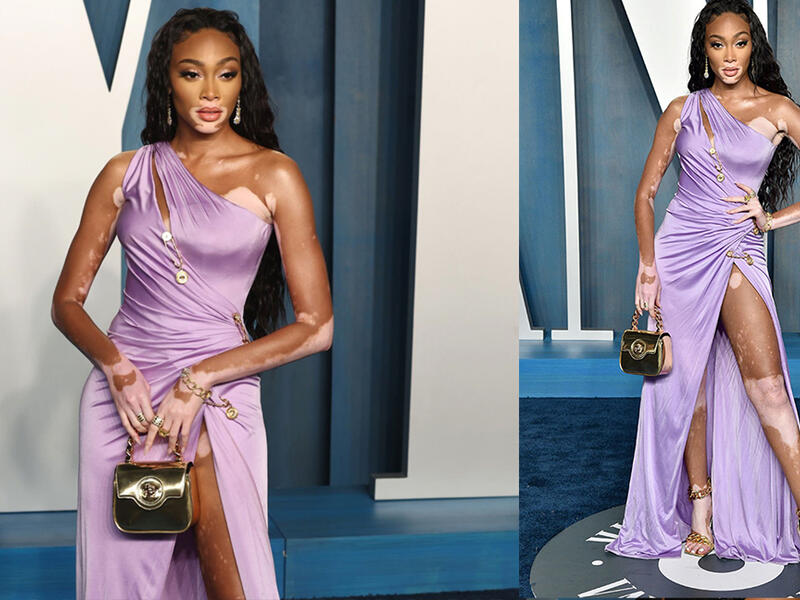 Winnie Harlow