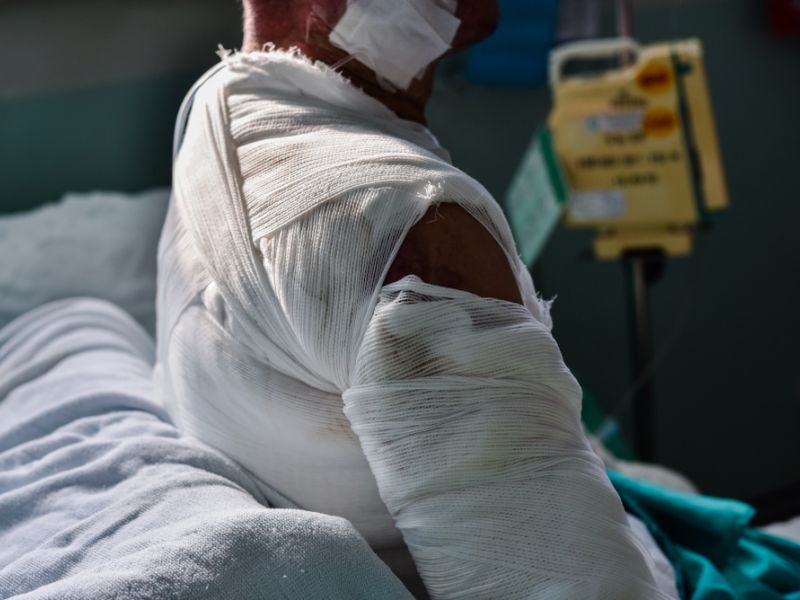 Man sets himself on fire after his mother rejected his fiancé