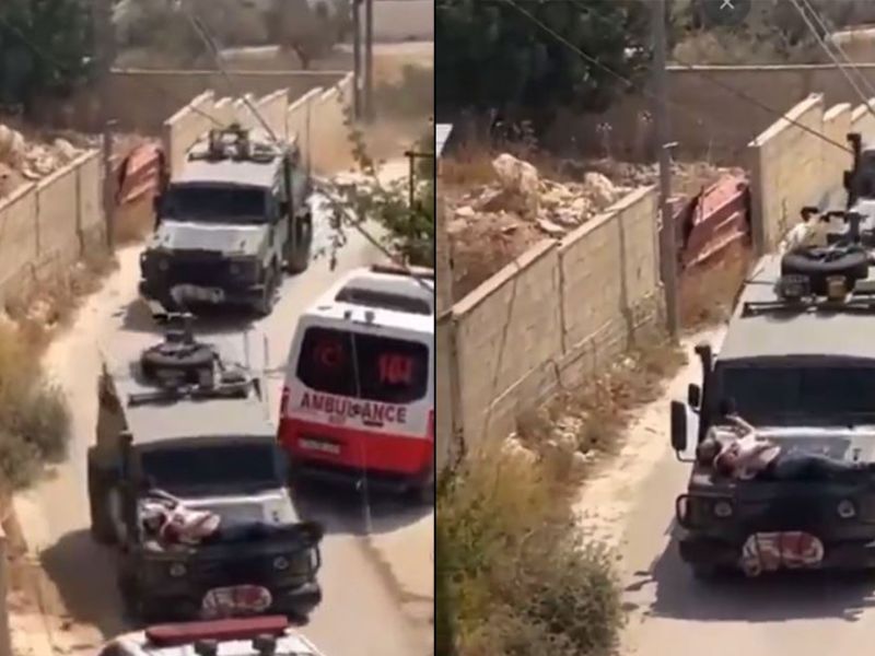 Injured Palestinian