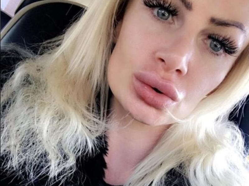 (Kerry Miles/ Instagram)