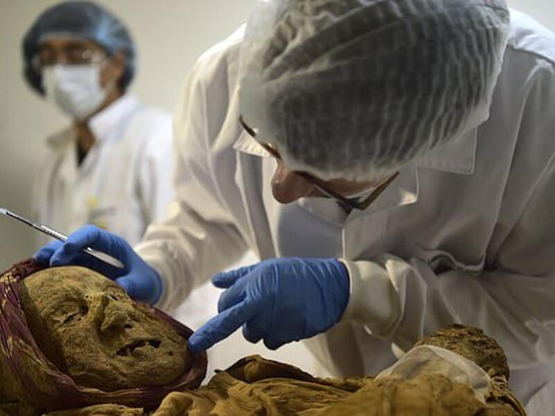 Dr Charlier studied the mummy for two days. He took samples of bone and dry tissue for genetic analysis and carbon 14, or radiocarbon which would provide more indications to the genesis of the disease (AFP)