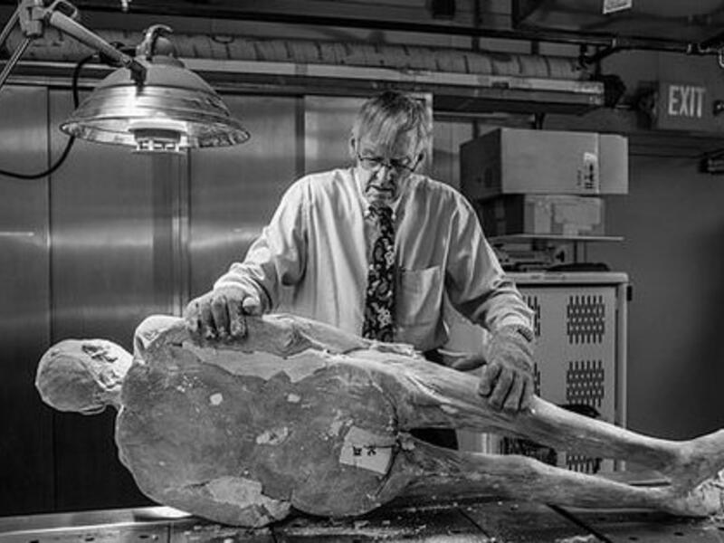 When Sue first volunteered herself, Dr Vic Spitzer said no, because of her various complications, including her hip replacement. Eventually he agreed, but it did mean some posthumous logistical acrobatics (Twitter)