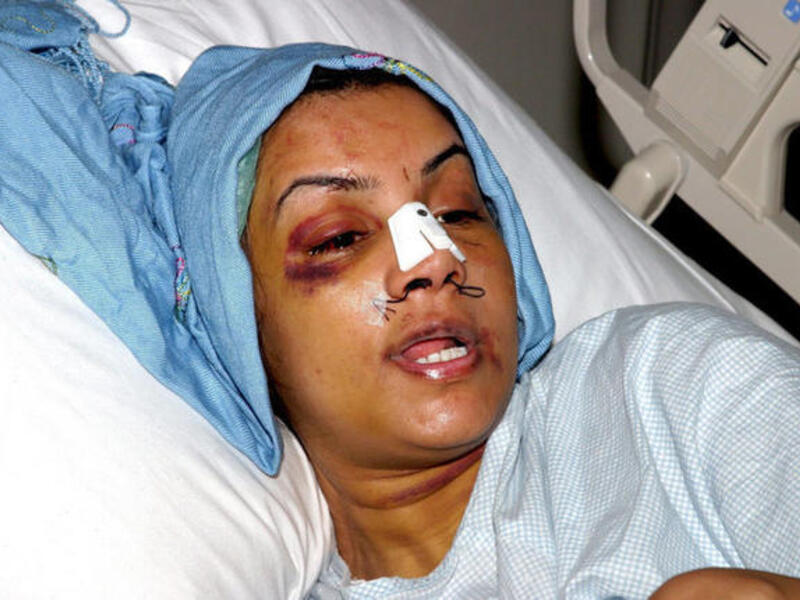 ‘Thank God we live in America': Oprah caused an upset in the Arab world, during an interview with battered Saudi Arabian wife Rania al-Baz, who in 2005 showed her face to Oprah & the world. Saudis objected that this face did not represent the average Saudi woman who lived a well-treated life.